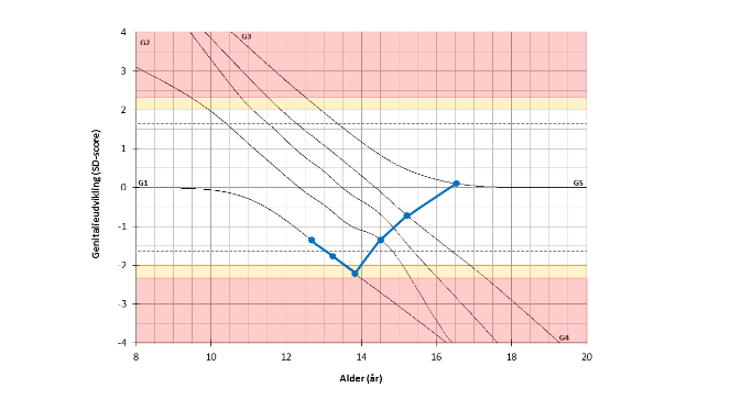 Eksempel på genitalieudvikling ved normal pubertet med noget sen onset