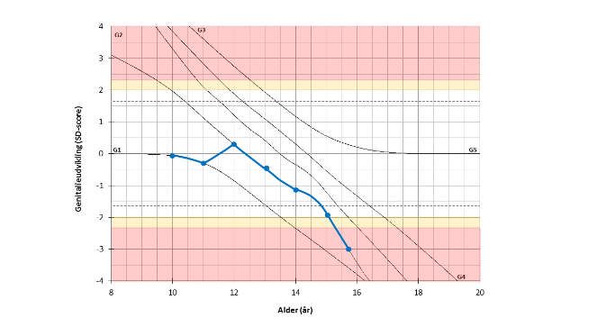 Eksempel på genitalieudvikling hos dreng med Klinefelter's syndrom